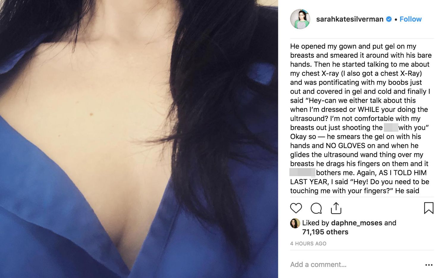 christine wilcock recommends sarah silvermans boobs pic