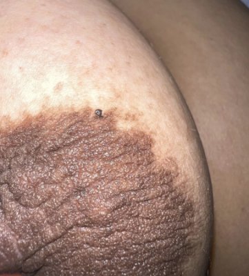 Big Dark Areola Pics submission tube