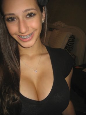 Best of Nude girls with braces