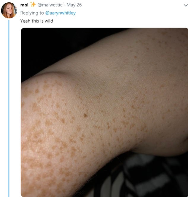 cassandra scott recommends freckles on boobs pic