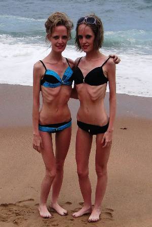 brendon horn recommends anorexic woman on beach pic