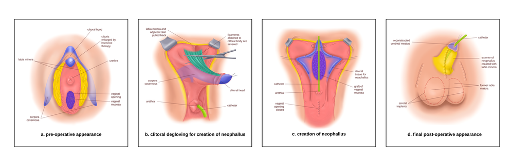 chris but recommends turning penis into vagina pic