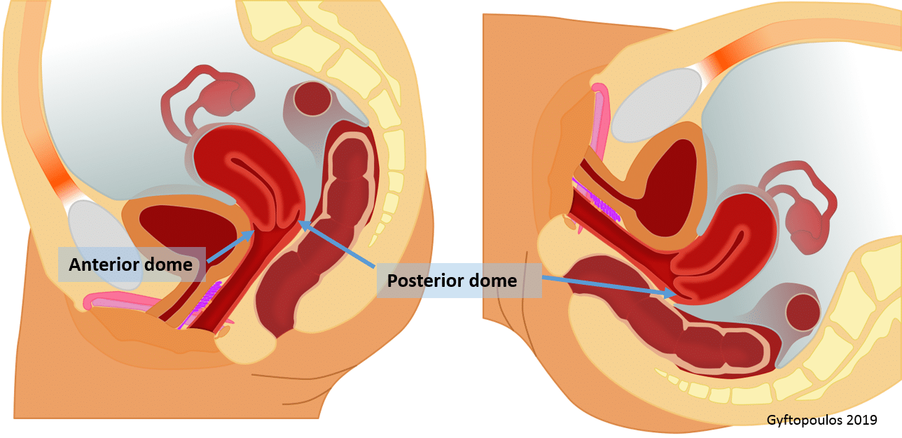 Turning Penis Into Vagina my girfriend