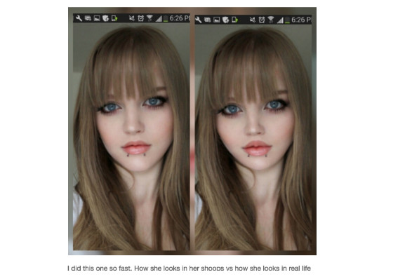 alison grimston add dakota rose before and after photo