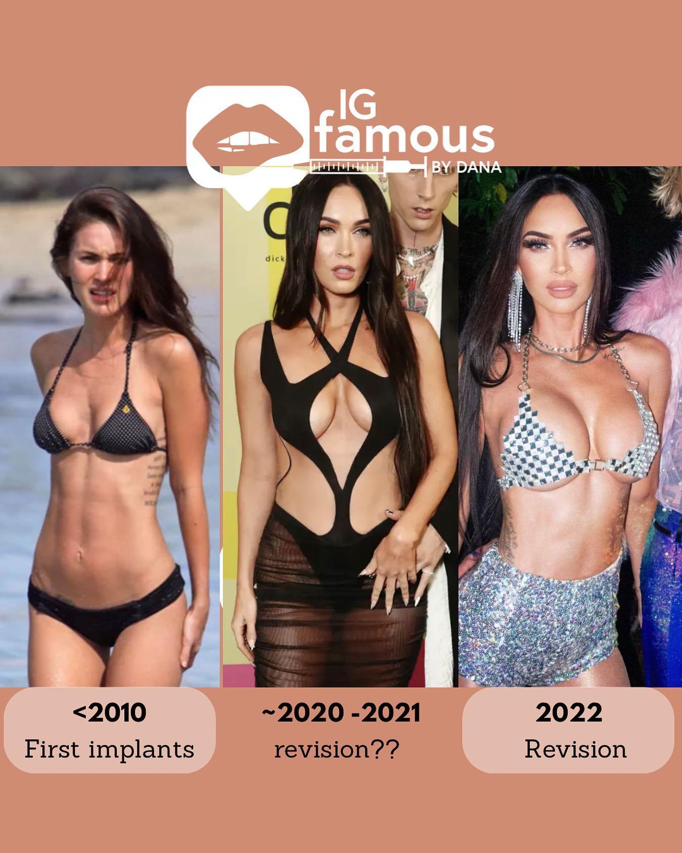 chuck harling add photo does megan fox have fake boobs