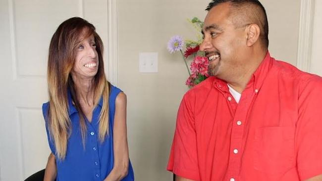 andrew masur recommends is lizzie velasquez married pic