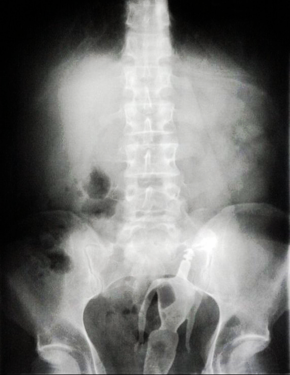 cathy mcandrew add photo x rays of people having sex