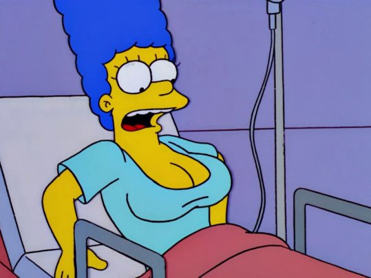 marge with breast implants