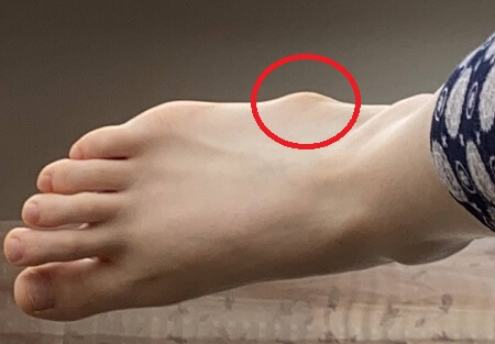 alex gardea recommends Tiny Feet Treat