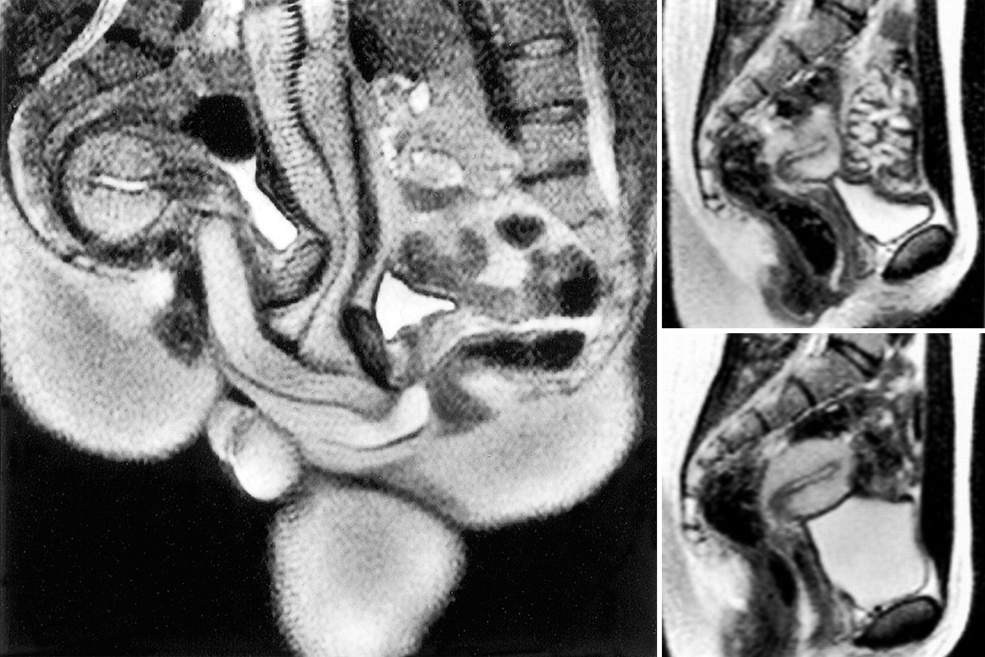 ashley clarke recommends X Rays Of People Having Sex