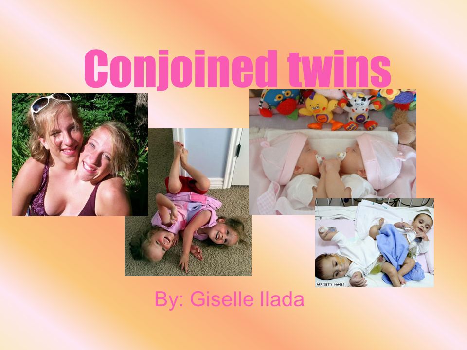 Best of Conjoined twins having sex