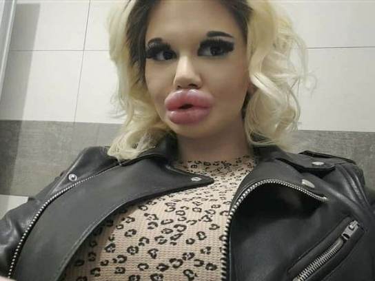 ashton raymond recommends big lips suck pic