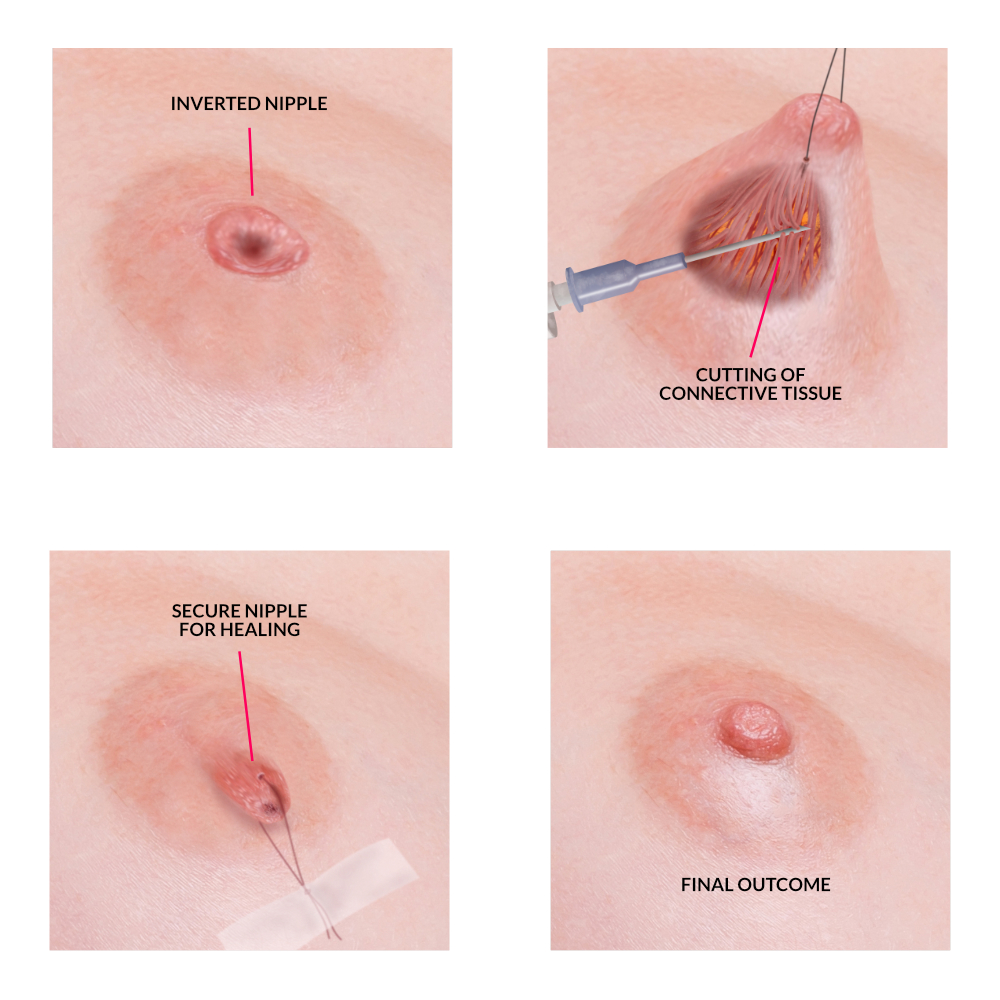 chris slocum recommends large nipple images pic
