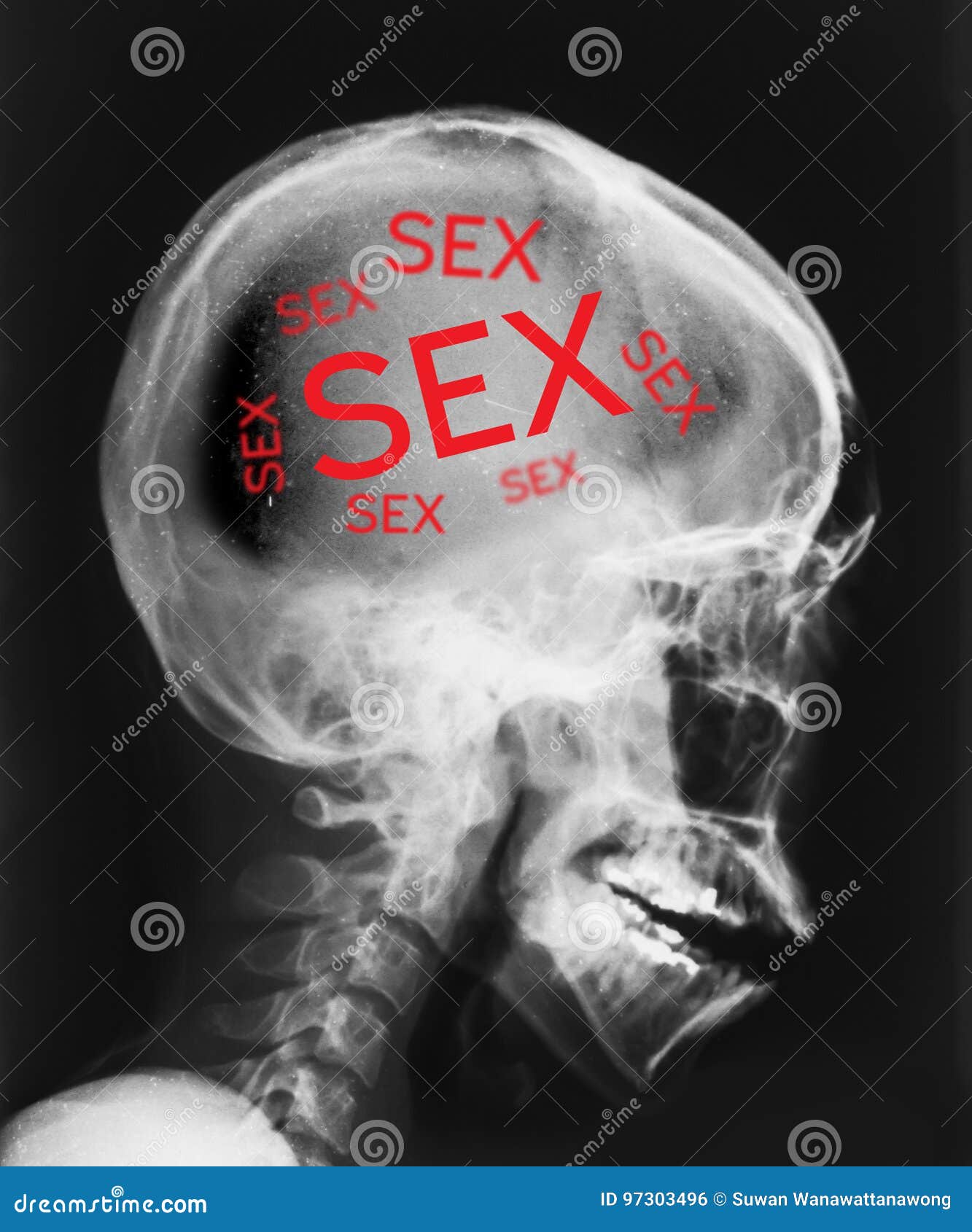 bibek pandit recommends X Rays Of People Having Sex