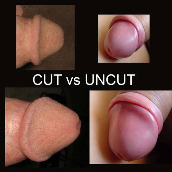 cornel trasnea add how to suck an uncircumsized penis photo