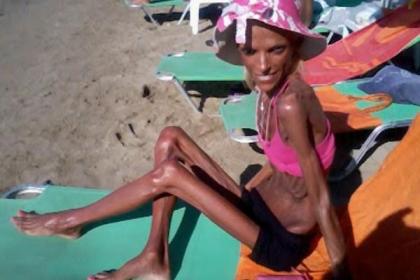 Best of Anorexic woman on beach