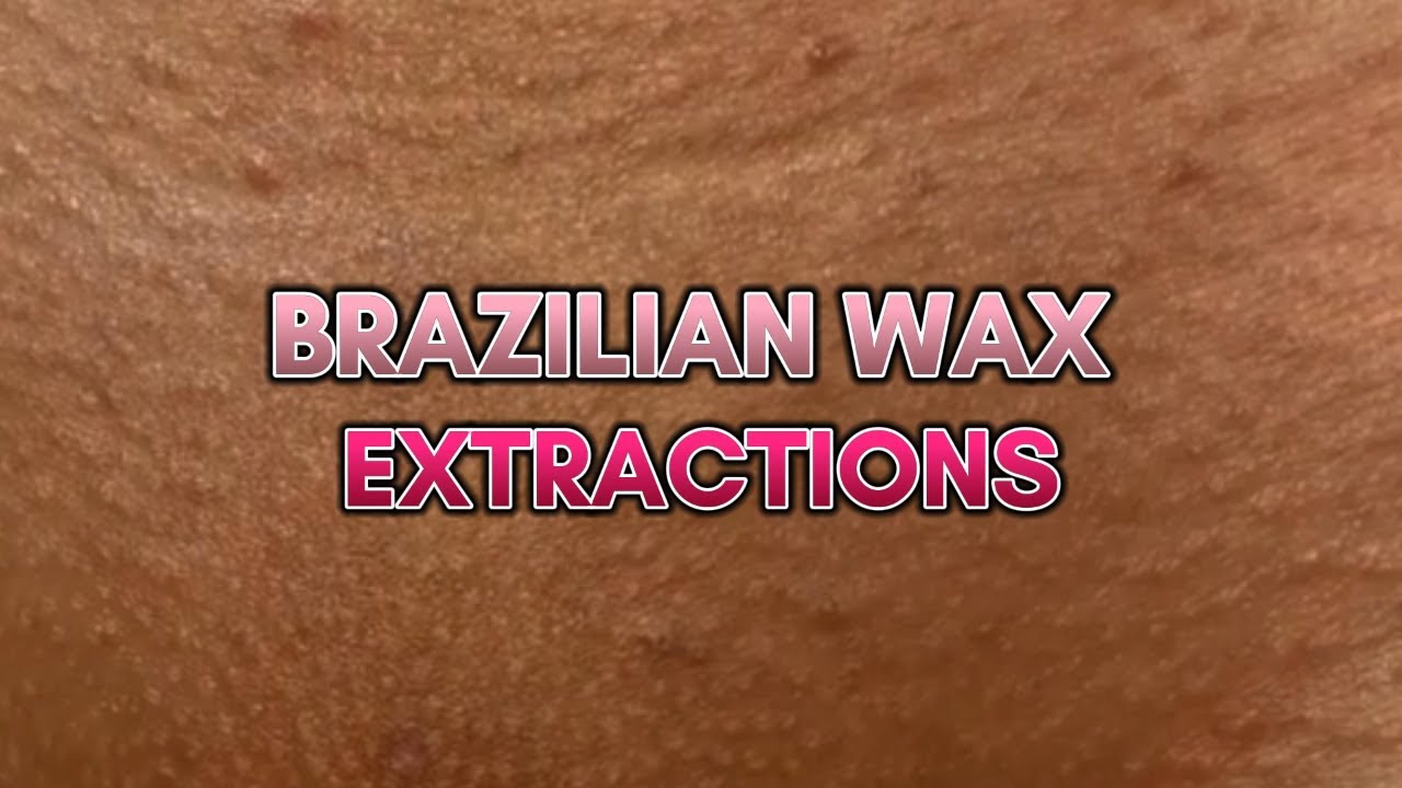 amouna ahmad recommends Photos Of Brazilian Wax