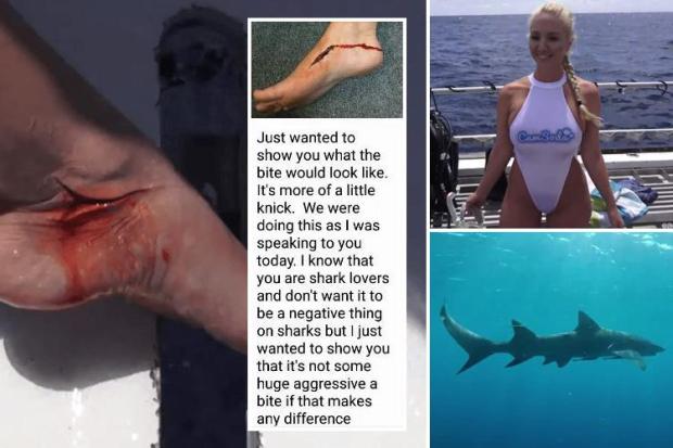 cheryl puckett recommends pornstar attacked by shark pic