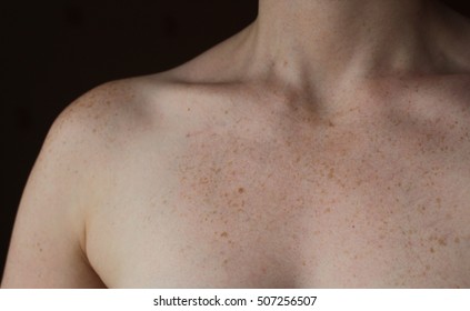 colby blythe share freckles on boobs photos