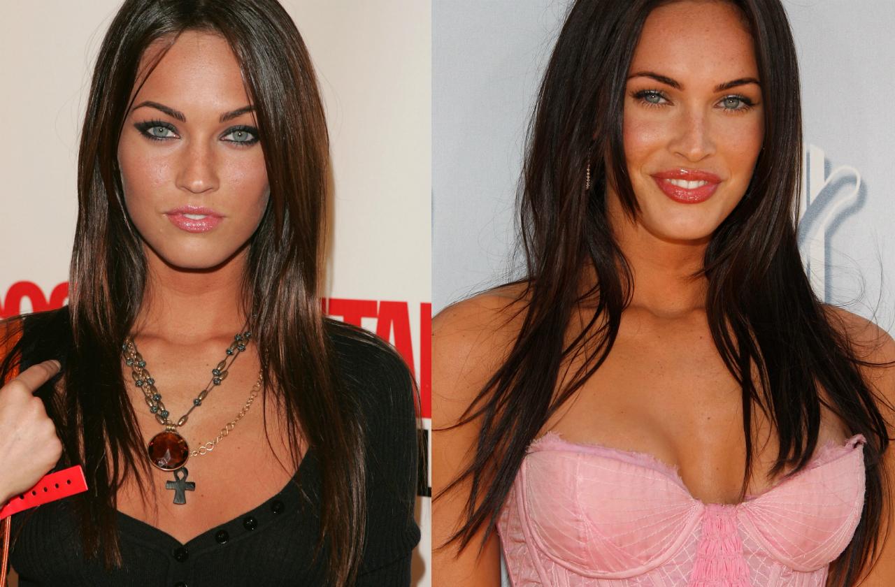 does megan fox have fake boobs