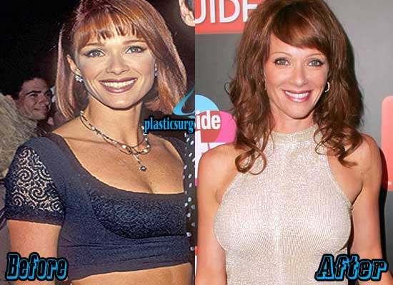 brennan mcgee recommends Lauren Holly Breast Implants