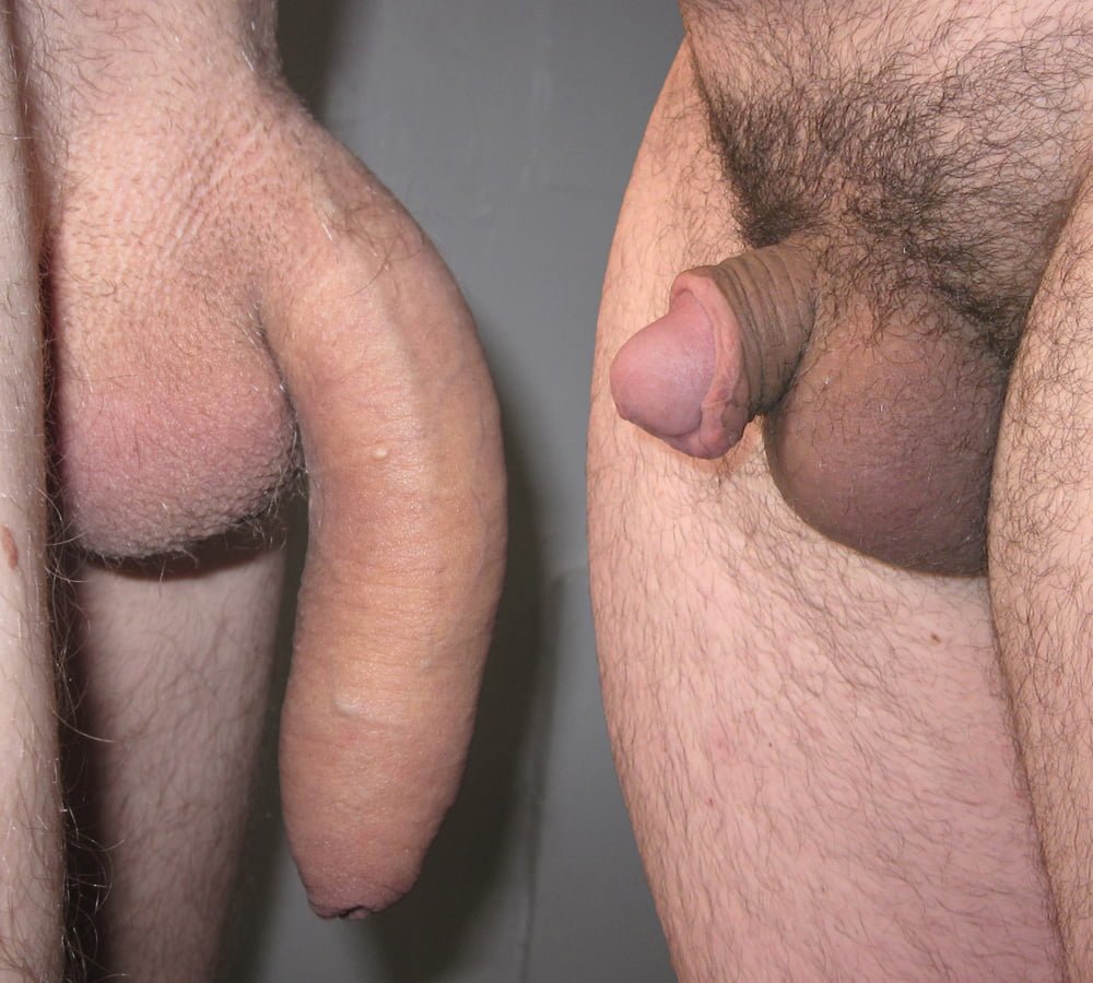 smallest penis gallery