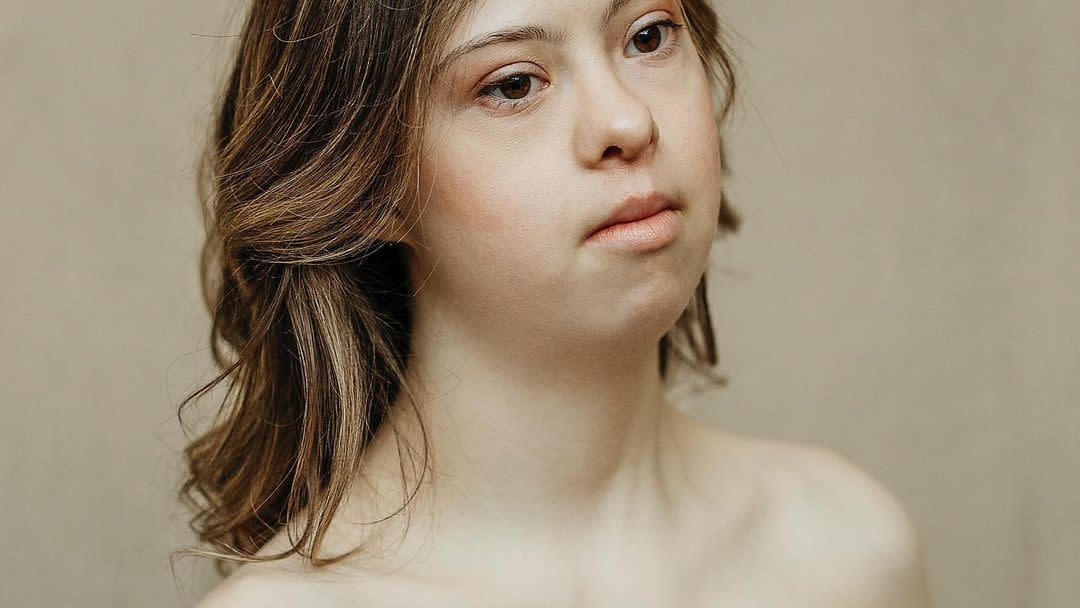 Best of Nude down syndrome girl