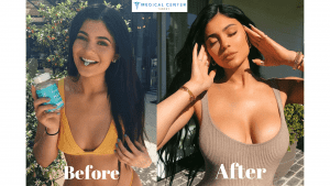 Best of Kylie jenner tit pics