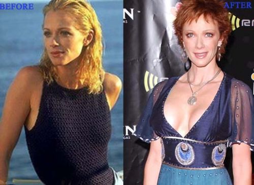 ayushi rana recommends Lauren Holly Breast Implants
