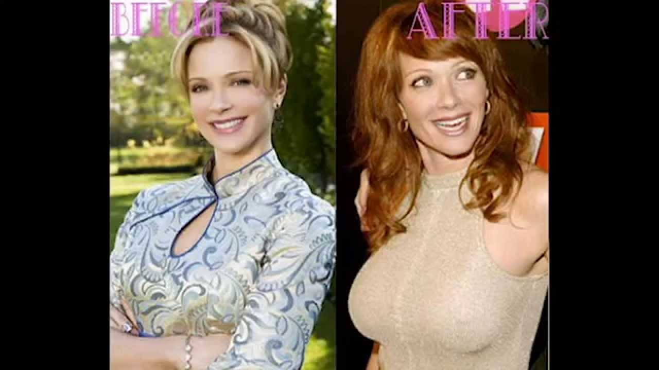 annette hutcheson recommends lauren holly breast implants pic