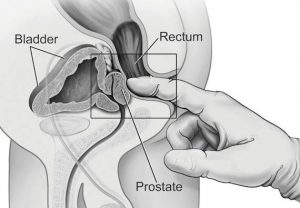 abhinav narula recommends male g spot orgasm video pic