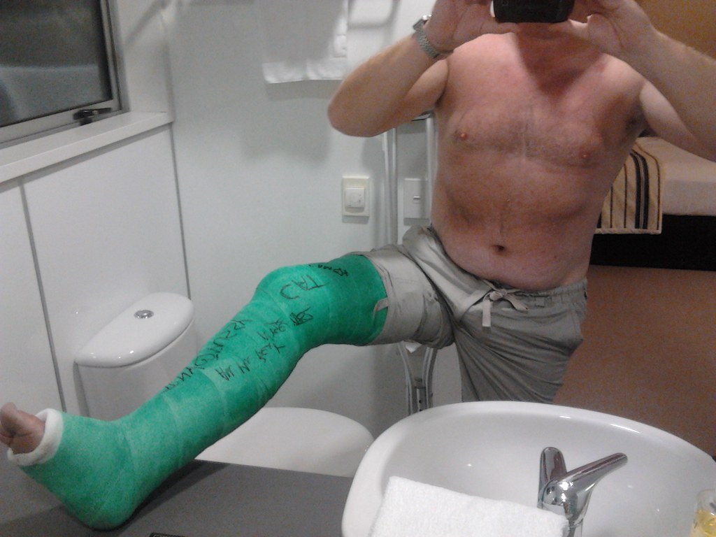 derrick astwood recommends men in leg casts pic