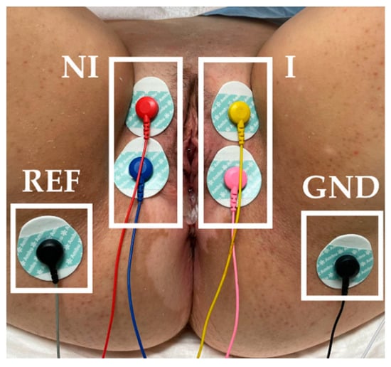 Orgasm With Tens Unit annabelle brady