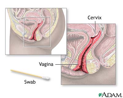david mani share penis stuck inside vagina photos