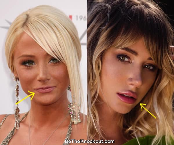 angie mccann recommends Sara Underwood Surgery