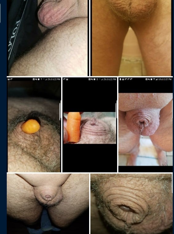 ali ahmad mohamad recommends smallest penis gallery pic