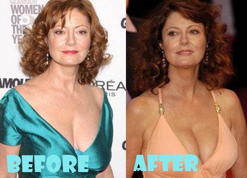 deb mackenzie recommends susan sarandon boobs pic