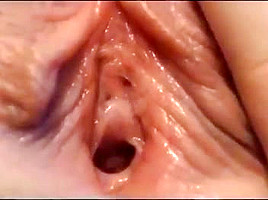 ahmad m abu amr recommends up close pussy hole pic